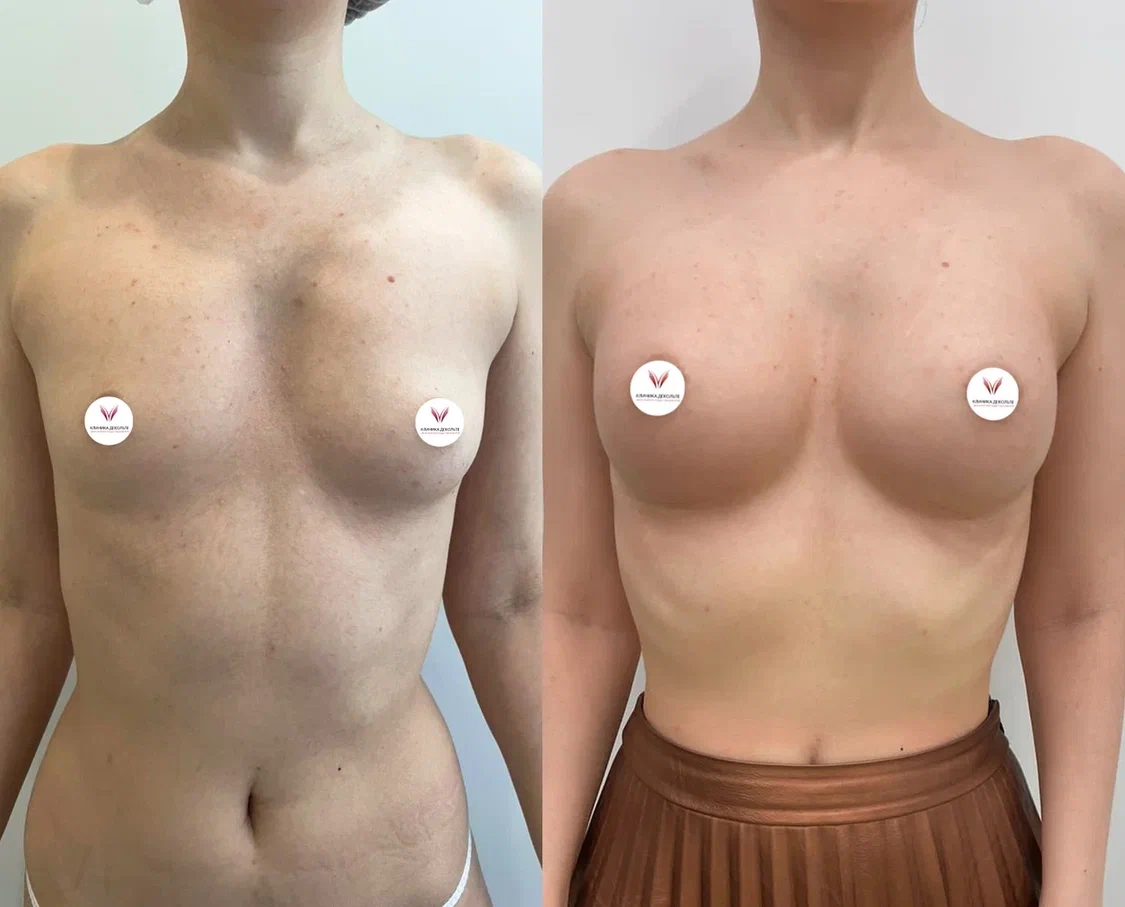 Фоновое изображение