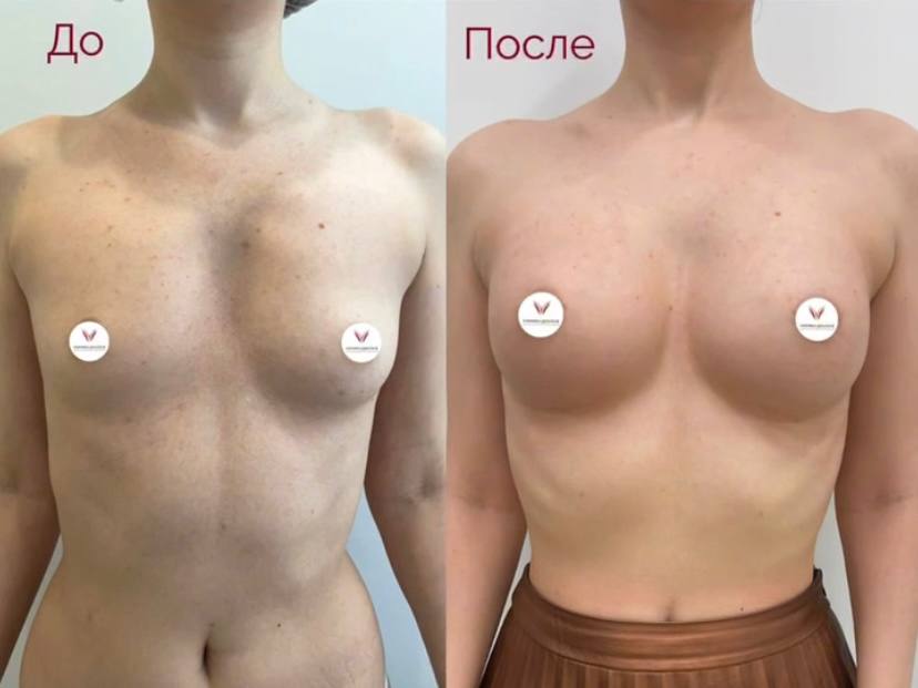 Фоновое изображение