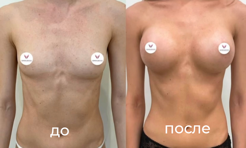 Фоновое изображение