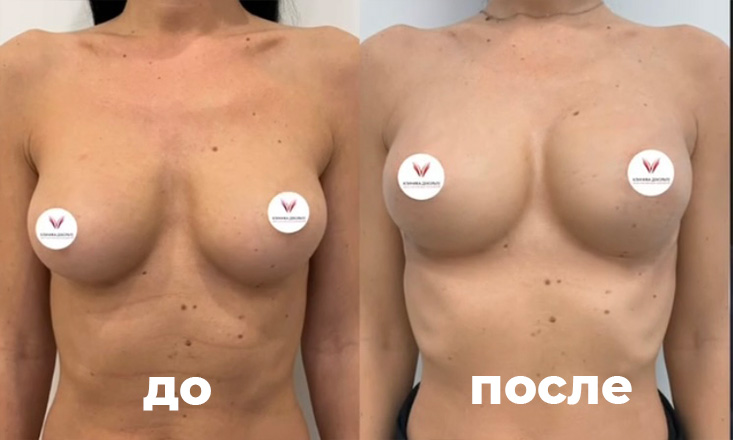 Фоновое изображение