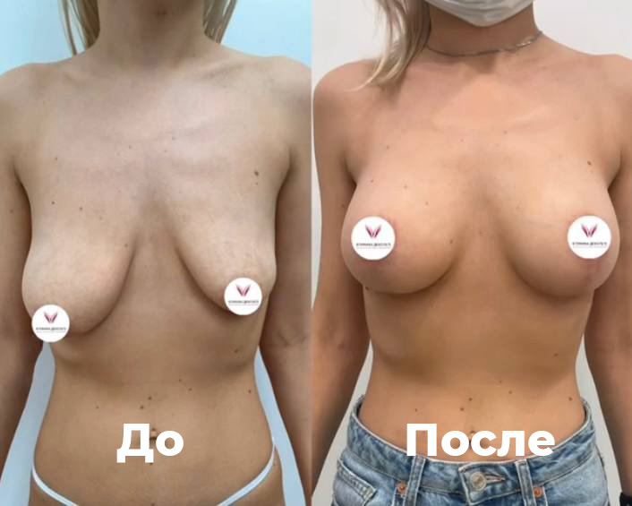 Фоновое изображение