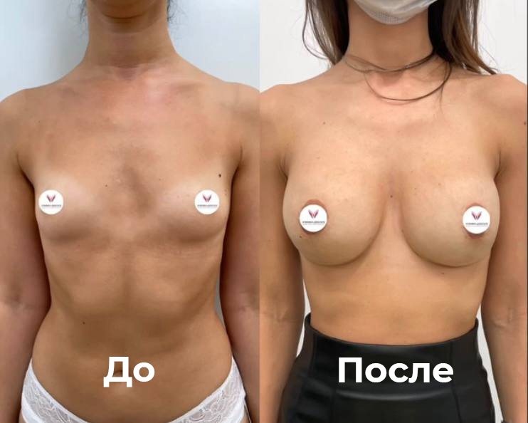 Фоновое изображение